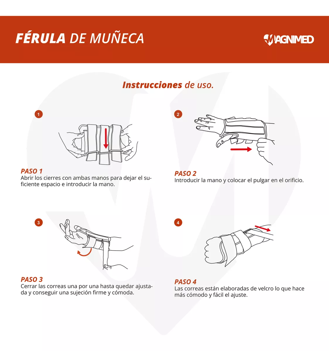 Sindrome del tunel carpiano