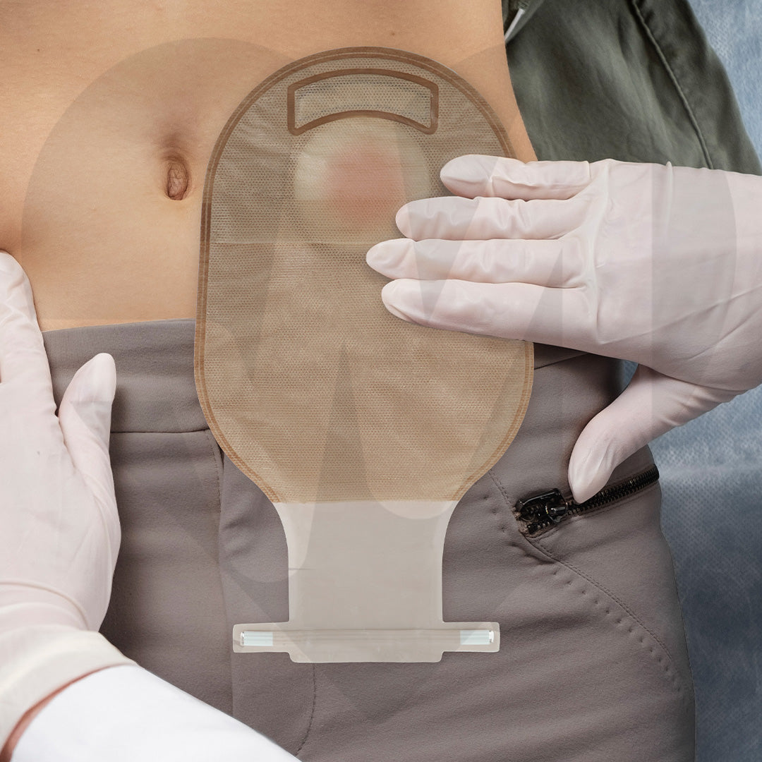 Pinza o clip de cierre de seguridad para bolsa de ostomía drenable.